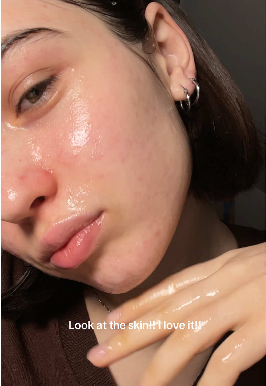 This mask definitely does its job! It’s the first time I’ve seen a mask that’s so full of essence -_- #kbeauty #koreanskincare #acne #soothing #dralthea 