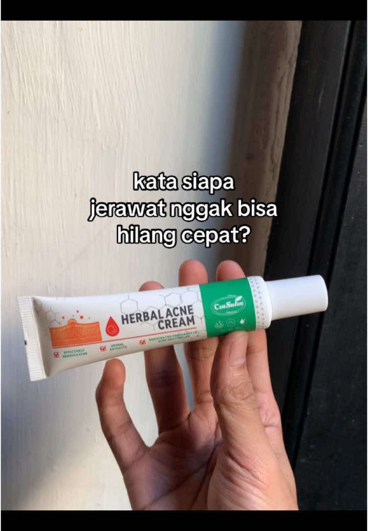 Buktikan sendiri #penghilangjerawat #herbalacnecream #krimjerawat #fyp 