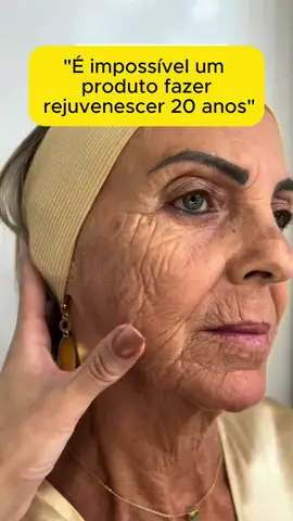 O site do tratamento original está aqui no meu perfil. #pelehidratada #mulheres #bigodechines #rejuvenescimentofacial #rejuvenescer #resveratrol #transresveratrol #skincare #tratamentofacial #pelesemrugas #calcificacao #mulher #vitaminac #rejuvenescimento #pelesemmanchas #mulhertrans #pele #pelesaudavel #acidohialuronico