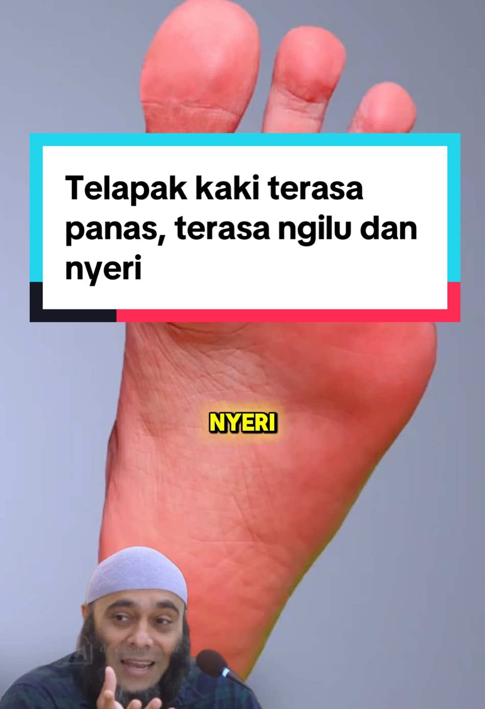 Telapak kaki terasa panas, terasa ngilu dan nyeri #telapakkakipanas #kakisakit #telapakkakisakit #ngilu #nyeri #cukananas #cukananaswithmother #cukananasorganik 