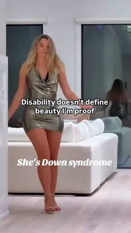 Hell no she’s Down syndrome #narutoshippuden #LearnOnTikTok #humour #LearnOnTikTok #gaming #downsyndrome #jajaja 