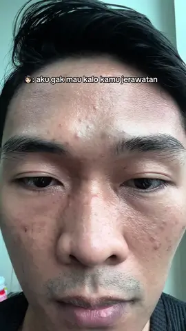 Eksfoliasi buat pemula.. gak usah ragu aku udah buktiin sendiri  #peelingsolution #g2gpeelingsolution 