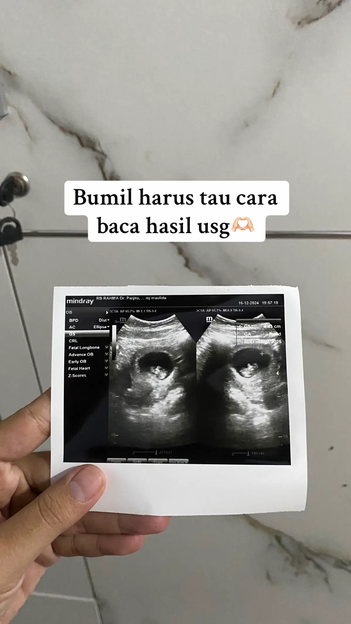 #bumilhappy #masyaallahtabarakkallah #fyp 