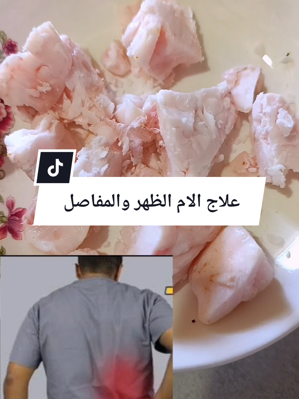 #علاج الام الظهر والمفاصل#علاج#الظهر#المفاصل-الركب#علاج#طبيعي#وصفة-مجربة#سهلة#for #france🇫🇷 #marocaine🇲🇦 #cutebaby #الشعب_الصيني_ماله_حل😂😂 
