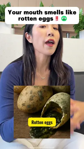 This probiotic oral spray is the most economical and effective one among many oral sprays I have used. It is suitable for everyone.#kisses #asmr #message #perfumes #mouthspray #OralCareSpray #probiótico#probiotics#tiktokshopholidayhaul#gosmile #mouth#kiss#tiktokshop #info#badbreath#springglowup   #springtok#oralhealth