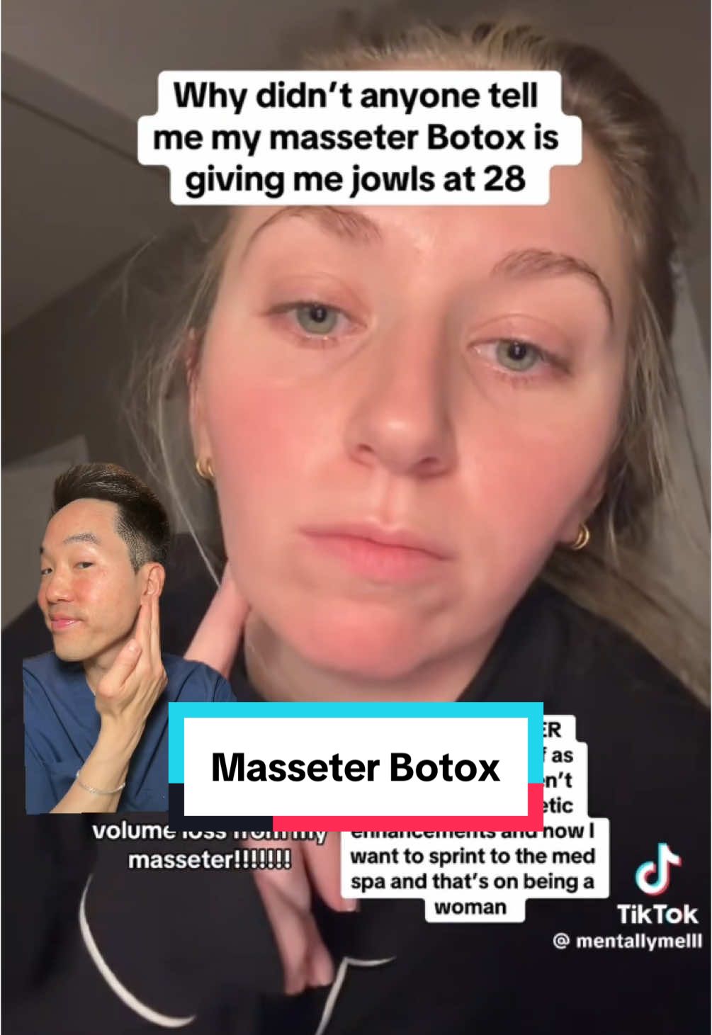 Masseter botox  #dermatology #dermatologist #drdavidkimderm #botox #masseter #skin #skintok  #greenscreenvideo #greenscreen 