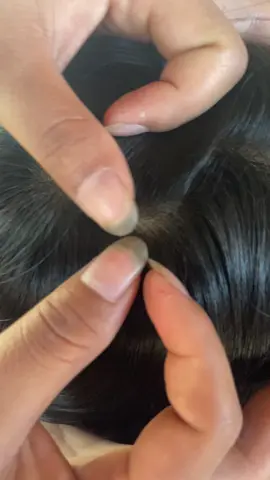 😱😱😱#omg #lice #liceremoval #treanding 
