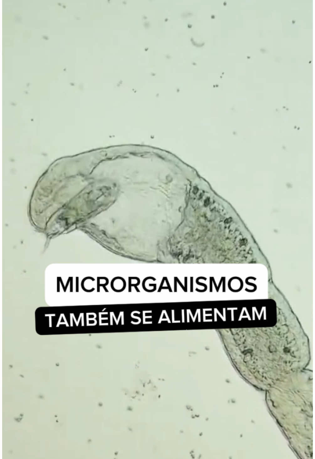 🦠 Você sabia que microrganismos também se alimentam? Mesmo invisíveis a olho nu, eles vivem, se movem… e se alimentam! 🍽️ Capturam partículas, absorvem nutrientes e até “caçam” o que precisam para sobreviver. #microbiologia #microrganismos #biologia #microscopio 