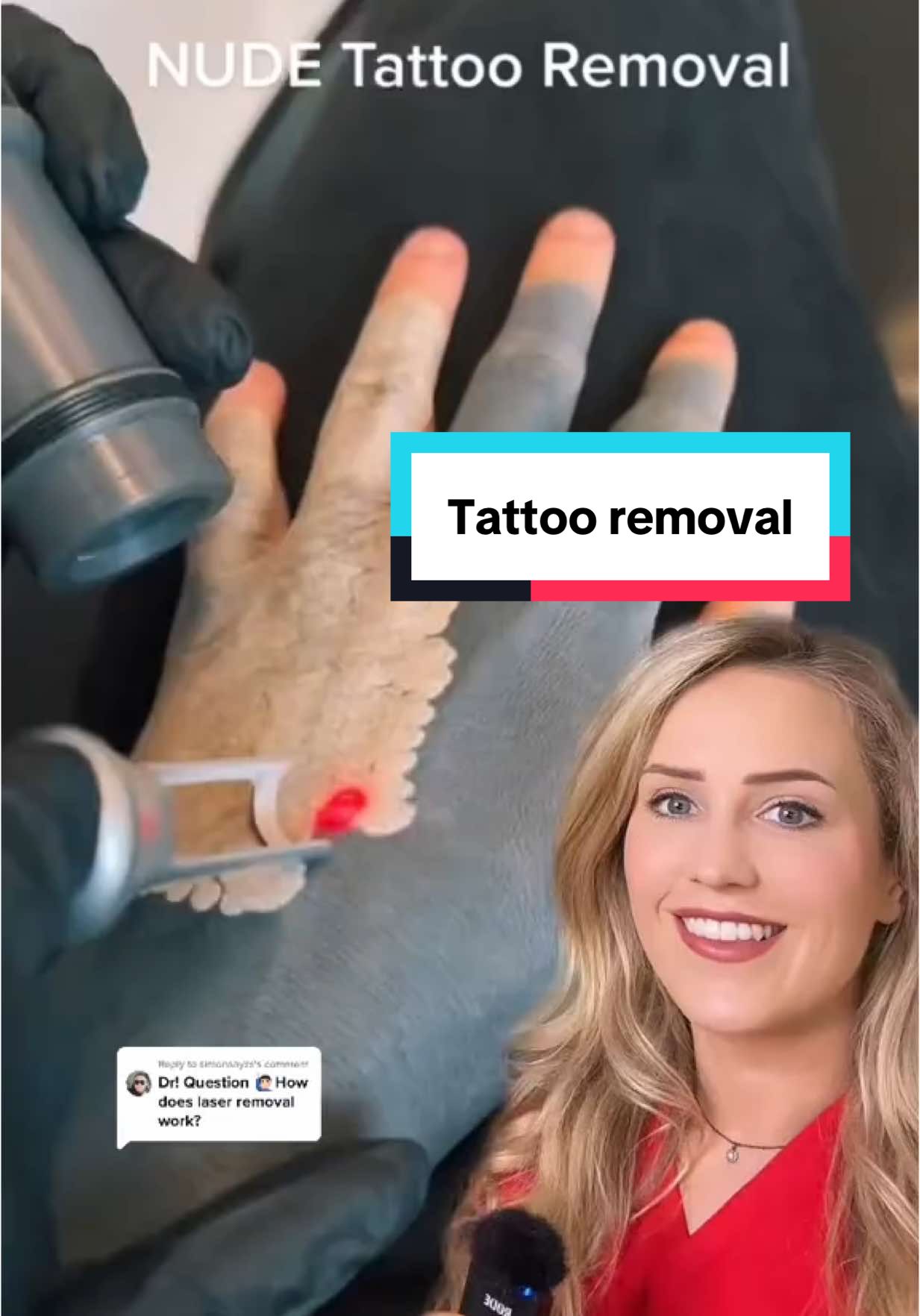 Did you know this about tattoos? 🤯 VC: @nudecph #tattoo #tattooremoval #tattoos #explained