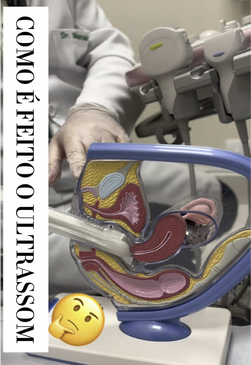 COMO É FEITO O ULTRASSOM TRANSVAGINAL? 🤔 #duvida #for #medicina #mulher #mãe #ultrassom #fyp #CapCut 