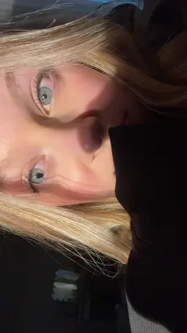 in your eyes, there‘s a heavy blue… #eyes #iriskolobom #blueeyes #fyp #viralvideos #pupil 
