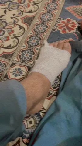 Bike accident 😭😭😭😭😭😭 leg finger facture kisi ki nazar lag gai 🥺🥺🥺🥹🥹🥹🥹#plzunfrezemyaccount #dontunderreviewmyvideo #freepalestine🇵🇸❤️ #freepalestine🇵🇸❤️ #foryoupageofficiall #toqueermughal123 #accident @HAMزA👀💸 