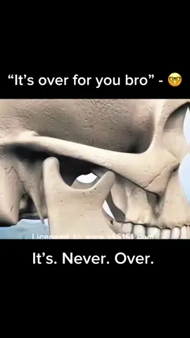 Sugerymaxxing is the last resort if all else fails. #surgery #surgerymaxxing #surgerymaxx #mog #ramus #holyramus #jawline #SelfImprovement #marlon 