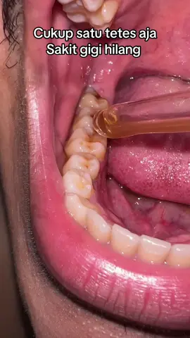 Mumpung promo #obatsakitgigi #obatherbal #obattetes #sakitgigi #supersakti 