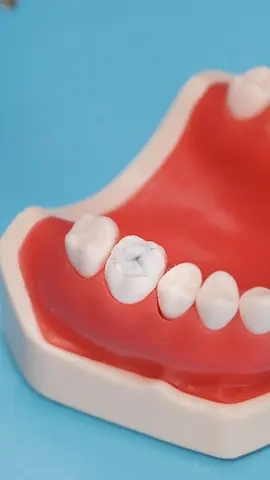 This is your sign to brush your teeth if you don’t want dental surgery 😬🦷🪥 #dentist #cavity #pov #howto #doctor #craft #fyp 