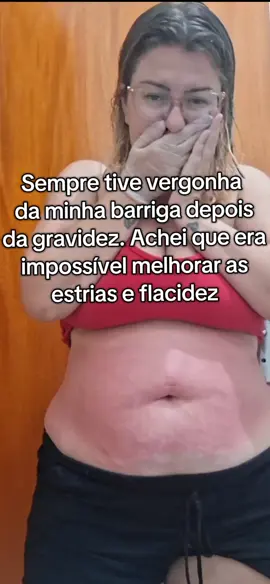 isso sempre me incomodou. Mas tem solução meninas #flacidezabdominal #estrias #belezabrasileira #cuidadoscomapele #cremeadeus 