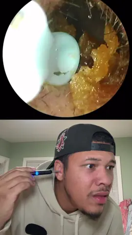 Best ear cleaning tool ever