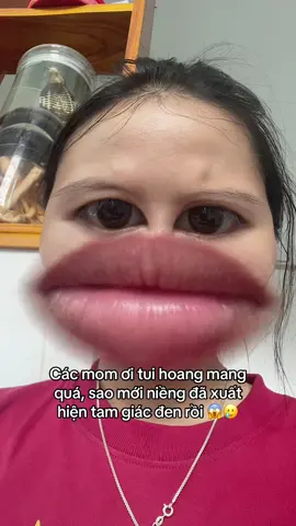 Rồi sau này nó có biến mất không vậy các đồng niềng ơi 🥹🥹🥹 #niengrang #niengrangmaccai #nhatkiniengrang #xh #fyp #viral #trending #maccaikimloai 