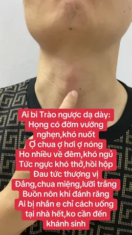 Trào ngược chữa sớm tráng biến chứng.Ai có dấu hiệu nhắn e #traonguocdaday #daudaday #videoviraltiktok #khotho #ochua 