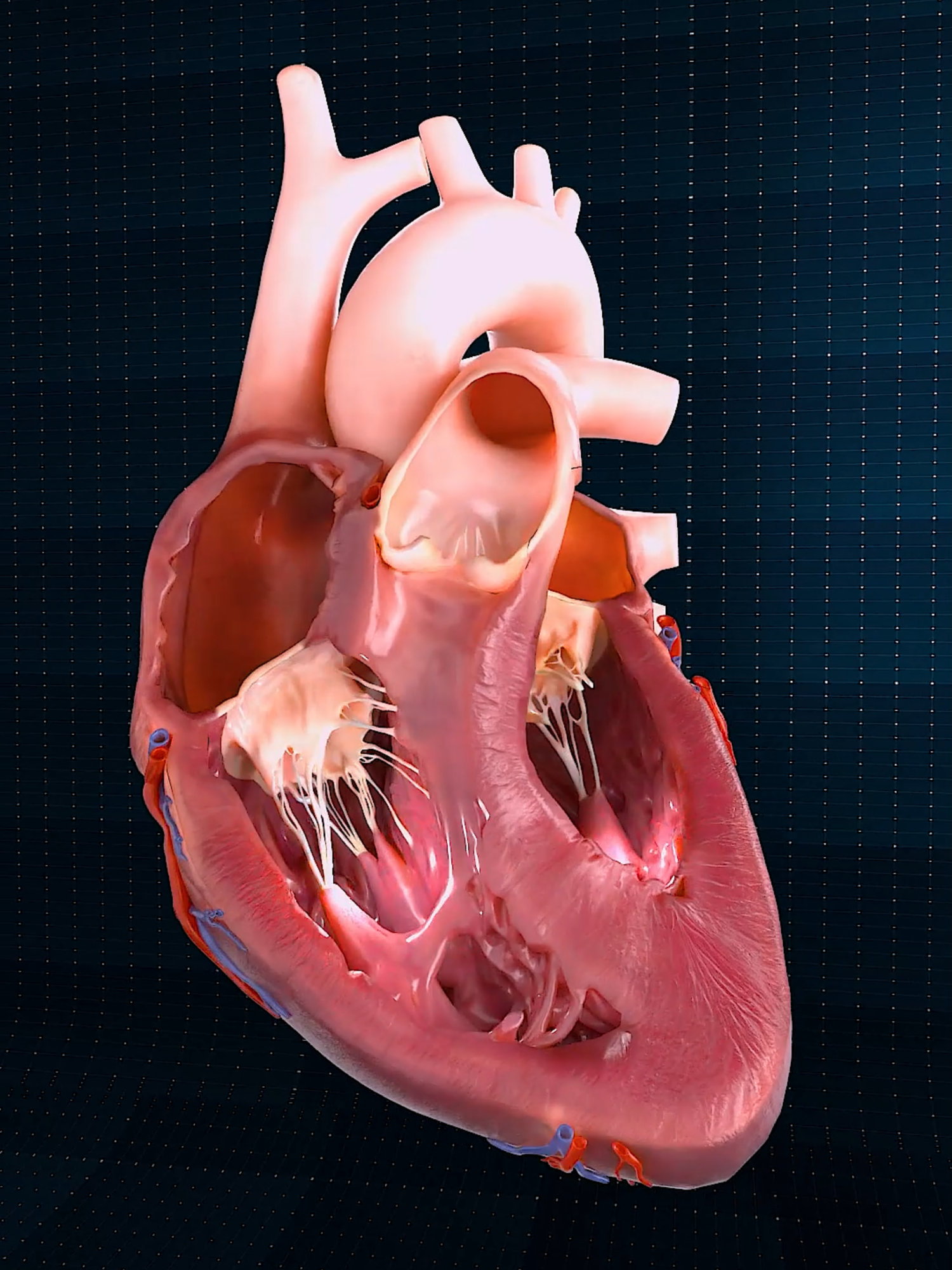 Close Up of a Beating Heart | (Anterior) 🫀 . . The human heart is a vital organ that pumps blood throughout the body, supplying oxygen and nutrients while removing carbon dioxide and waste products. Here are some key points about the human heart: Anatomy: The heart has four chambers: two upper atria and two lower ventricles. The right side pumps deoxygenated blood to the lungs, while the left side pumps oxygenated blood to the rest of the body. Valves: There are four main valves (tricuspid, pulmonary, mitral, and aortic) that ensure unidirectional blood flow through the heart and prevent backflow. Circulation: The heart is part of the circulatory system, which includes the pulmonary circuit (to and from the lungs) and the systemic circuit (to and from the rest of the body). Electrical System: The heart has its own electrical system, including the sinoatrial (SA) node, which acts as the natural pacemaker, regulating the heartbeat. Health: Maintaining heart health is crucial, as cardiovascular diseases are leading causes of morbidity and mortality. Lifestyle factors such as diet, exercise, and avoiding smoking play a significant role in heart health.💓. . . #smartdoctor1 #cardiology #anatomia #anatomía #education #cardio #anatomi #ANATOMY #anatomy #heartanatomy #medicina #3danimation #doctor #pregnancy #pulmonaryhypertension #pregnant #baby #gravidez #medstudent #animation