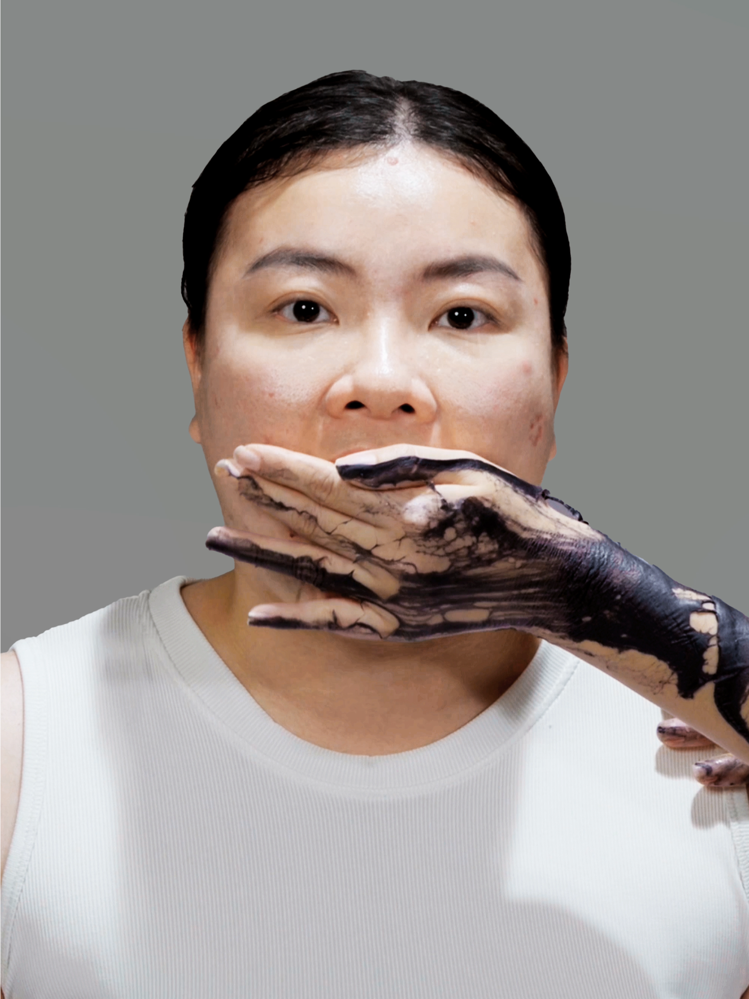 Mụn nội tiết chẳng cần bôi thoa? Khi bên tai có người quả quyết “không uống thuốc thì sao mà hết được, bôi chét chỉ làm mụn nặng thêm”, thì ta khó mà không “vái tứ phương”. Thế là sa vào những thang thuốc hòa lẫn cùng corticoid, kháng sinh được 