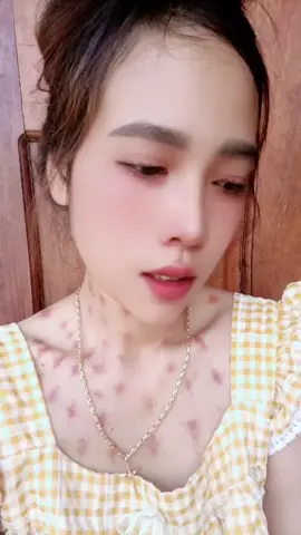 #xuhuong #sclk 