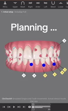 #orthodontist #orthodontics #invisalign 