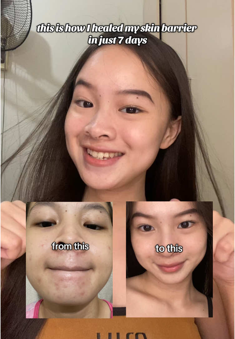 7x!! 7x!! girls you must watch this💗 #drleo7xceramide #7xceramide #drleomoisturizer #drleo #drleoph #skincare #repairbarrier #sensitiveskin #sensitive #acne #redness #moisturizer