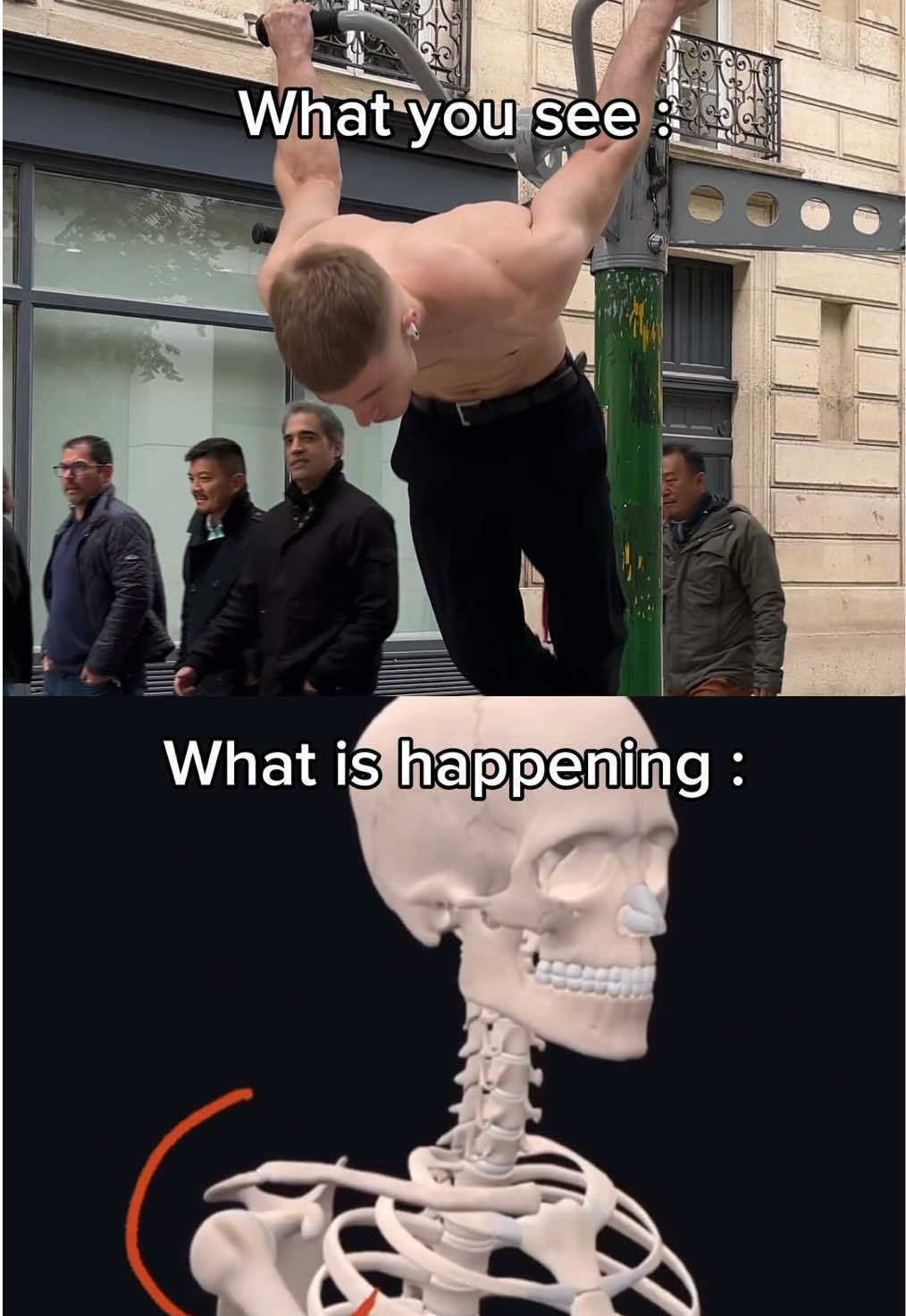 Tap to understand it all 👇 That shoulder movement you see is called “circumduction” It's the sum of all the movements that the shoulder basically allows : flexion/extension, adduction/abduction, and eventually internal/external rotation In layman's terms, the shoulder is like a ball that can move in circles within its socket, thanks to its unique anatomical structure The typical example for understanding this is the warm-up we all know, which consists of rotating your arms in space, as if you were drawing circles ⭕ In relation to my video, it's after having made a complete turn that my shoulders return to their initial position However, you can see that I stop turning on myself after one and a half turns and go back the other way because I can't go on any further 🤔 Well, this is due to my wrists blocking me as I'm holding a pull-up bar with my hands ✊ If my wrists weren't blocking me, I could do an infinite number of turns ! This is typically the case when using rings, as they too will rotate because they are suspended from straps And this way, my wrists will no longer be blocked and will follow the same movement as the rings If you're interested in discovering and using my personal and complete flexibility routine on a daily basis, with no equipment or experience required... Then I'll let you click on the link in my bio to find it ✅ #flexibility #mobility #stretching #supple #stretch #stretches #yoga #pain #health #gymnastics #gym #training #workout #calisthenics #exercise #amazing #bodyweight #streetworkout #tutorial #tips #advice #shoulders #rotatorcuff #dislocation #shoulderdislocation #challenge #physique