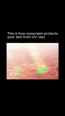 Sunscreen is essential in protecting the skin from the harmful effects of ultraviolet (UV) rays, which can cause premature aging, DNA damage, and increase the risk of skin cancer. It works by forming a barrier that either absorbs or reflects UV rays, preventing them from penetrating the skin. Broad-spectrum sunscreens protect against both UVA (aging) and UVB (burning) rays, helping to maintain skin health and prevent sunburn, hyperpigmentation, and the breakdown of collagen. #Sunscreen #UVProtection #SkinCare #BroadSpectrum #SPF #SunSafety #SkinHealth #HealthySkin #AntiAging #SunDamage #ProtectYourSkin #UVRays #SkinCareRoutine #SunProtection #SkinCareTips #CollagenBoost #SunburnPrevention #ClearSkin #SkincareEssentials #DailySunscreen #SkinCareScience #BeautyRoutine #SunCare #HealthyGlow #BeautyTips #SkincareCommunity #SunProtectionMatters #Dermatology #SkinCareEducation #HealthyGlow #BeautyScience 
