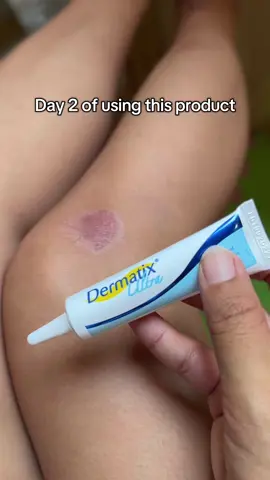 Day 2 💖 #dermatix #scar #scarremover #ConSantanderConecto 