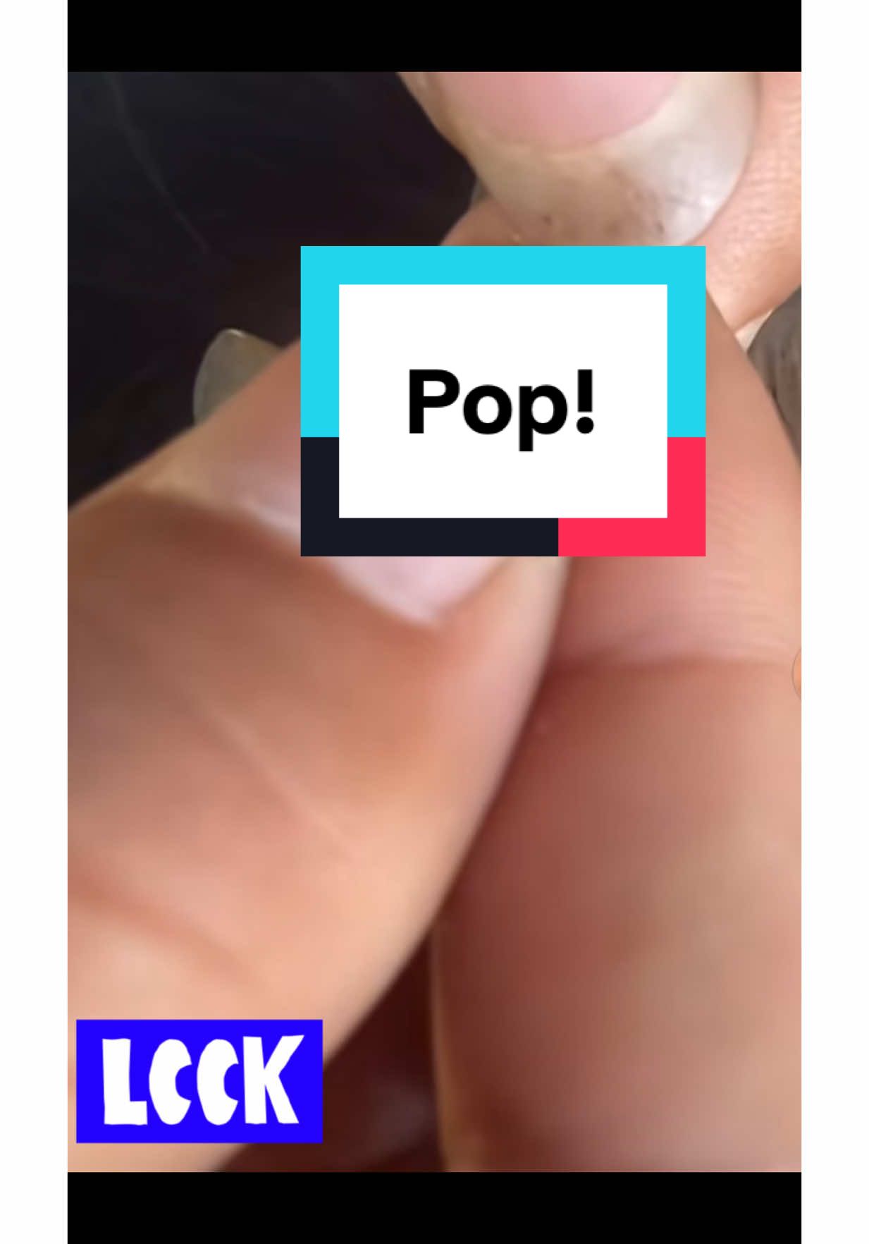 Vidéo #satisfying #pouxdanscheveux #titokviral 