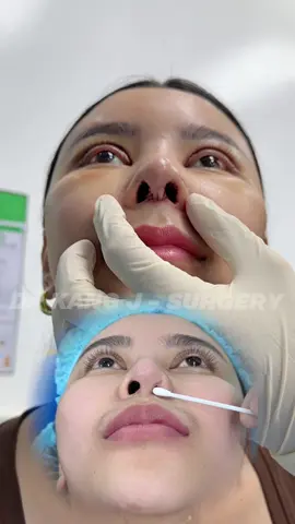 Part 2 | Rhinoplasty surgery failed due to faulty facility #comesticsurgery #surgery #hidungmancung #operasihidung #drkangJ 