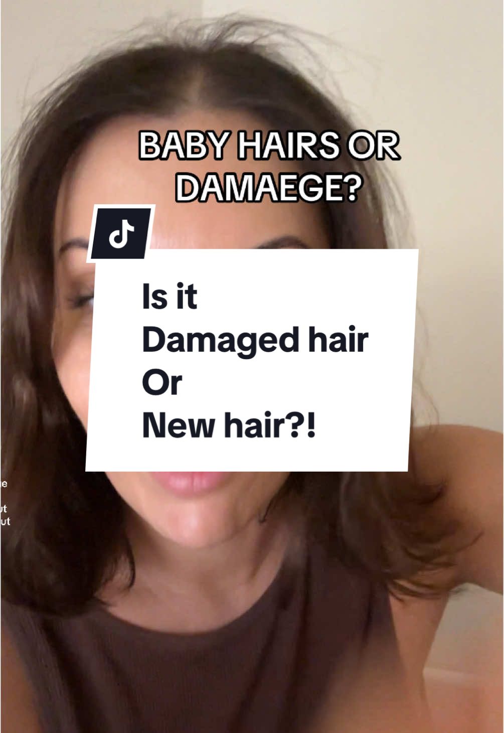 Also means you have a healthy scalp!! #hairtips#hairgrowth#hairloss 