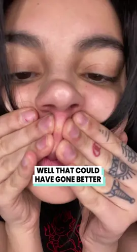 Ouch @officialkristenkash #fyp #pimplepopping #disasters  Well that could have gone better