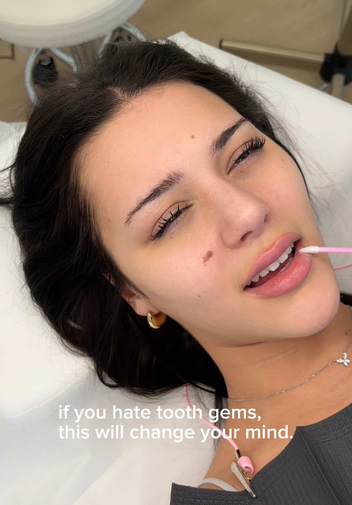 tooth gems + 30 minute whitening combo ~ undefeated 😮‍💨🦷💎 last piece of content from Alisha’s set I’ve been cheeky with the uploads ik u guys are probably tired of it 🤣😘 Her gem set consists of 4 fun styles: An OG butterfly, a single OG ss5 on the canine, bold OG fangs on the bottom (temps), and the cutest confetti lateral in St. Vincent, baby pink + a baby pink kawaii star to match 💎 📝 Products Used This Session:  - Lip applicator brush in pink - Clip-on Comfort Retractor -  Island Smiles Glorious Glide Gingival Barrier -  Island Smiles Passionfruit Martini & Piña Colada Cocktail Gels - Island Smiles Wax Tipped Applicators in Pink - Island Smiles Barrier Charms -  Island Smiles Black Pre-bent Syringe Tip -  Island Smiles Magenta Pre-bent Syringe Tip -  Island Smiles Rosè Handheld Curing Light with Crystal Cutie💎 -  Island Smiles Bubble Swabs in pink -  Island Smiles Flower Power Gel Remover Stix in pink -  Island Smiles Luxury LED Protective Goggles in Pink + White Why Cocktail Gels? * FAST results with HP 💨 * ADDITIONAL & LONG-LASTING whitening with CP ⏳ * Safe for sensitive teeth 🦷 * Brightens smiles for up to 12-14 hours post-session! * Vegan & non-toxic 🌱💚 * Safe for enamel and free from harmful chemicals! 🙌 💌 Book online, DM, call/text to book an appointment 📲 647-458-9288 🛍 Shop Teeth Whitening & Tooth Gem Supplies 👉 ISLANDSMILESTEETHWHITENING.CA ✨ 🎓 Contact Us for training inquiries! 🦷 Contact Us to book an appointment! . . #teethwhitening #torontoteethwhitening #teethwhiteningtech #teethwhiteningtraining #teethwhiteningspecialist #islandsmiles #torontotoothgems #torontoteethwhiteningtraining #torontotoothgemtraining #teethwhiteningsupplies #teethwhiteningsuppliestoronto #torontoteethwhiteningsupplies #toothgemsupplies #toothgems #toothgemsupplier #torontomobileteethwhitening #toothgemstoronto 