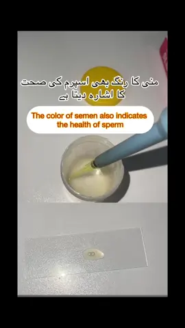 Healthy Sperms under microscope #semenanalysis #fertilityawareness #tiktokviral #fertility #medicalawarness #foryouu #foryouu 
