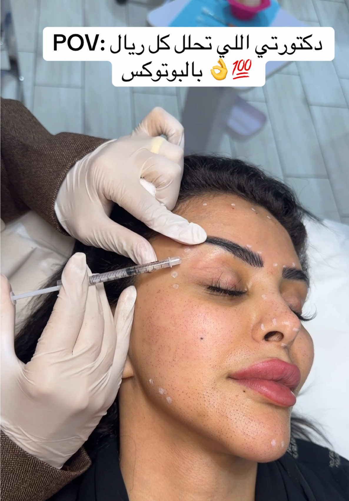 البوتوكس عندنا ب نوستالجيا يفوووووز  #matrixpro #بوتكس_تجاعيد #بوتكس_الوجه #بوتوكس #بوتكس_تجاعيد #بوتكس_الوجه 