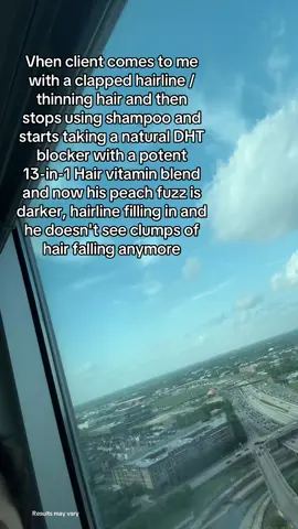 Take care of your body and your hairline will thank you 🙏 #hair #hairtok #balding #malepatternbaldness #minoxidil #finasteride #haircare #TikTokShop #resultsmayvary DISCLAIMER: This is not medical advice and stricly my personal experience. Results may vary depending on the person. Always consult with a medical professional.