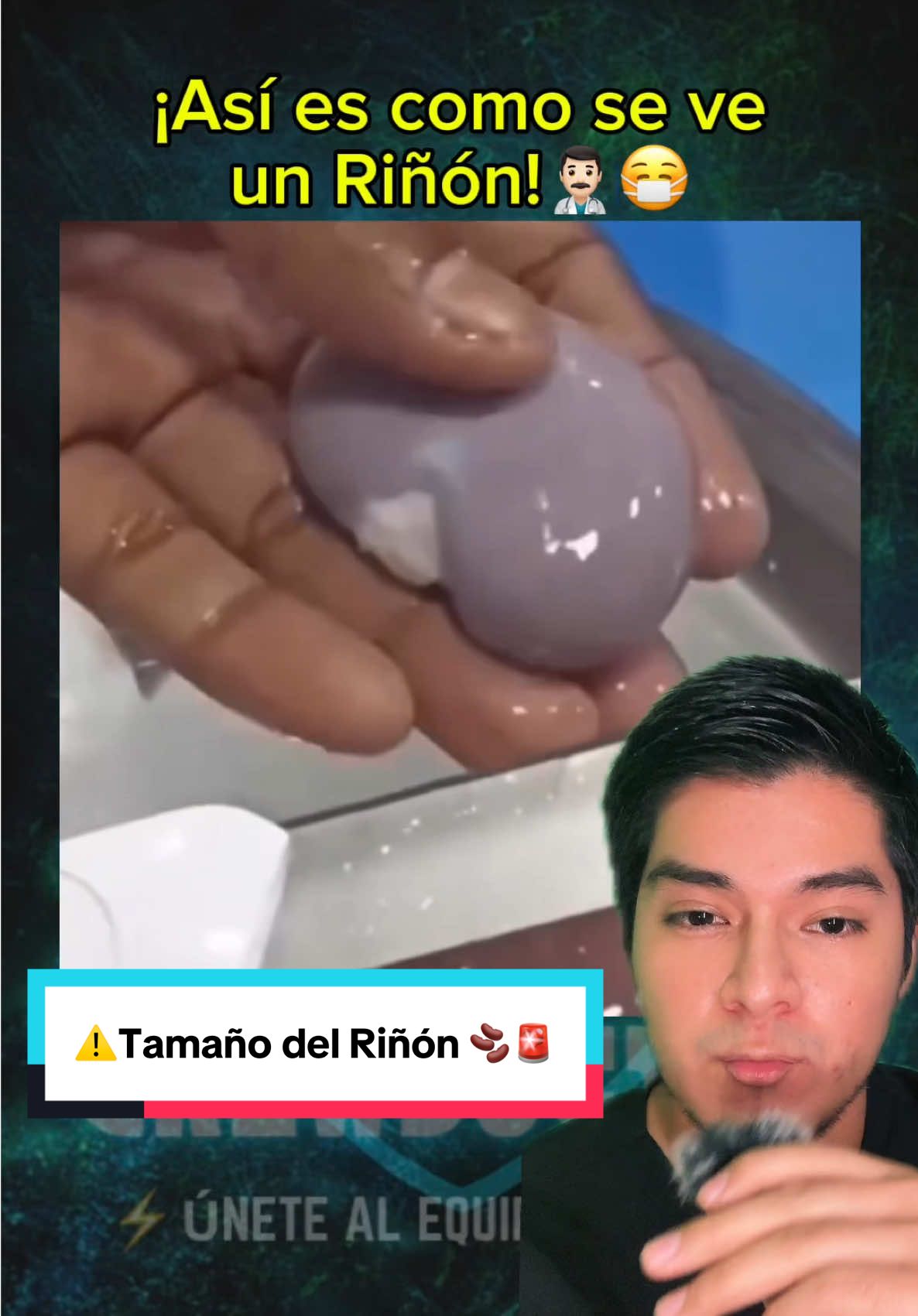 ⚠️El riñón se parece a una habichuela 😳🫘 . . . #riñon #riñones #crewdoctor #dreliacimynfante #estudiantedemedicina #estudiantedeenfermeria #salud #medicina #SabiasQue #conocimiento 