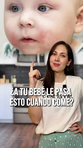 ¿Tu bebé se enrojece alrededor de la boca después de comer? 👶🏼 Muchos papás se preocupan al ver esta reacción, pero no siempre es una alergia. En este video te explico por qué sucede, qué alimentos lo provocan más y cuándo es momento de consultar al especialista🩺✨ 👩🏻‍⚕️ Dra. Ana Paola Franco 📍 Hospital Angeles Valle Oriente  🏥 Consultorio 1202 ☎️ 81 82 08 8806 #AlergiasInfantiles #DraAnaPao #Alergologa #Pediatra #AlergiasAdultos #urticaria 