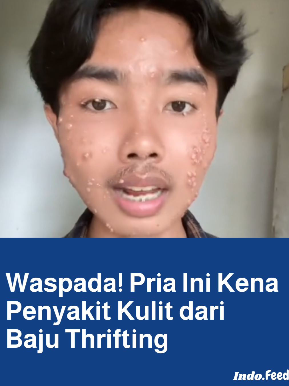 Sebuah video viral di TikTok menampilkan pengakuan seorang pria yang mengaku terkena penyakit kulit Moluskum Kontagiosum usai memakai baju bekas alias hasil thrifting. Video tersebut diunggah oleh akun @onenevertwoo dan langsung ramai diperbincangkan netizen. Meski tren thrifting makin populer, penting untuk tetap menjaga kebersihan dan mencuci pakaian bekas sebelum dipakai agar terhindar dari risiko kesehatan. #Thrifting #MoluskumKontagiosum #ViralTikTok #PakaianBekas #KesehatanKulit #TrenThrifting #IndoFeeds