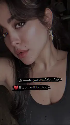 لـــم يكــــن اسكـــوت مـــن ذهـــــب بل مـن شـــدة التعــــب...؟! 💔
