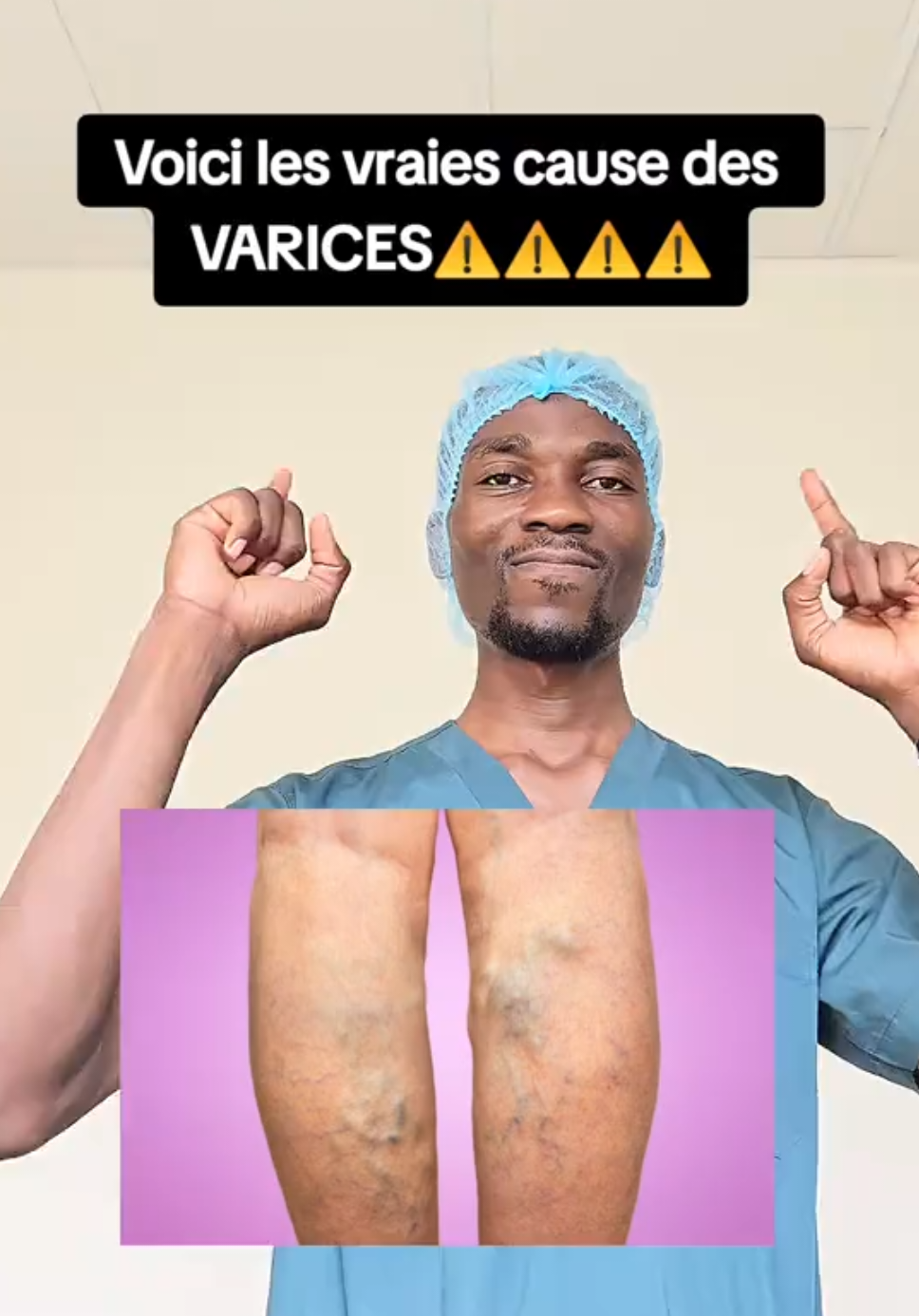 Les vraies causes des VARICES.  #tiktokfrance🇨🇵 #usa_tiktok #astucessanté #docteurnevylbakala #italy #varices #docteur #femme 