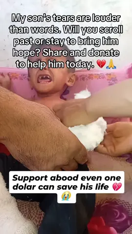 My son's tears are louder than words. Will you scroll past or stay to bring him hope? Share and donate to help him today. 💔🙏