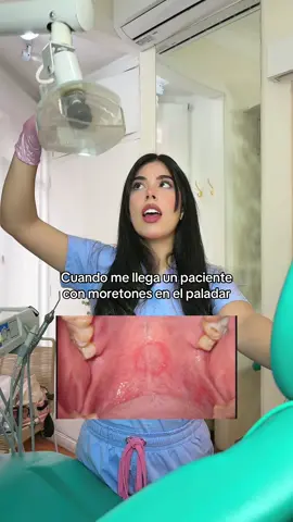 Es humor no empiecen, también puede ser un signo de hipertensión 