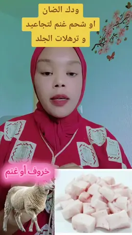 #tiktoklive #livehighlights  شحم الخروف (اللية) له استخدامات شعبية قديمة في العناية بالبشرة، خصوصًا في بعض الثقافات التي تستخدمه كمرهم طبيعي، ومن أبرز فوائده المحتملة لتجاعيد البشرة: ترطيب عميق للبشرة: الدهون الطبيعية في شحم الخروف تساعد في ترطيب الجلد بعمق، مما يقلل من مظهر التجاعيد الناتجة عن الجفاف. غني بالأحماض الدهنية: مثل حمض اللينوليك، وهي مفيدة لتحفيز إنتاج الكولاجين، الذي يدعم مرونة البشرة. مضاد طبيعي للأكسدة: يحتوي على فيتامينات مثل A وE التي تحارب الجذور الحرة، والتي تسهم في شيخوخة الجلد. يعزز التئام الجلد: يُستخدم موضعيًا للمساعدة في شفاء التشققات والجروح الطفيفة، مما يجعل البشرة تبدو أنعم وأكثر نضارة. إجراء اختبار حساسية قبل الاستخدام. #شحم #كريم_شحم_الخروف #كريم_شحم_الخروف #شحم_لية_الخروف #الشحم #محاربة_التجاعيد #ترميم #ترميم_حاجز_البشرة #كولاجين #كولاجين_طبيعي_للبشره #كولاجين_للبشره #كولاجين_طبيعي #نعومه #نعومة #نعومة_البشرة #ازالة_التجاعيد #ازالة_التجاعيد_ومحاربة_الشيخوخة #بشرة #بشرة_صحية #بشرة_صافية #بشرة_نضرة #بشرة_دهنية #خالية_من_المواد_الكيمائية #خالية_من_العيوب_والتصبغات #تجديد_الخلايا #فراشات #فراشتي🦋 #فراشات_التيك_توك #فراشاتي_الحلوين🥺🦋 #فروالة_برتقال_للأبد #فراشات_التيك_توك #فراوله🍓🍓🍓🍓🍓 #فراولة #فراولة_التيكتوك🍓 #امهات_المستقبل #كولاجين_طبيعي_للبشره #كولاجين_حلال #كولاجين #كولاجين_حيواني #كرزاتي #كرز 