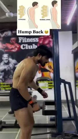 Fix your Back Hump ✅ Read captions 👇 Transform your body in 8 weeks with our Ultimate Shred Workout Program! 💪 Plus, get exclusive bonuses to supercharge your results. More details: link in my bio! ⬆️ #workoutplan #sports #GymTok #gymmotivation #Fitness #workout  #viralvideo #viral #bodybuilding #bodybuilder #usa🇺🇸 #canada🇨🇦 #america #europe #england #usa_tiktok