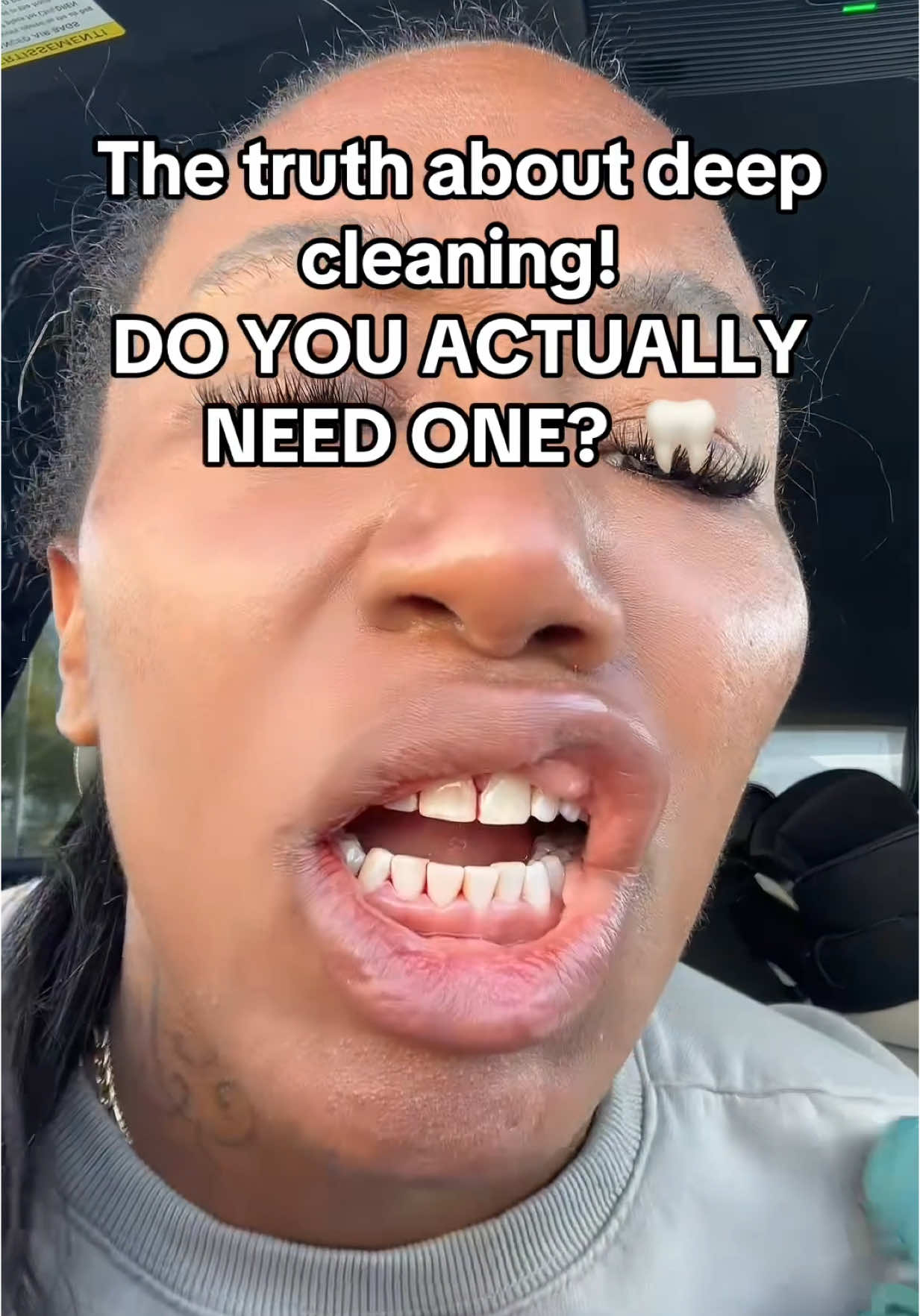 The Truth About DEEP Teeth Cleanings! 😭🦷 #teeth #braces #dentist 
