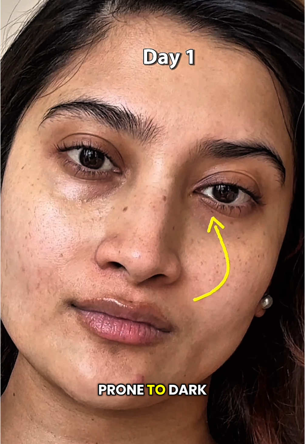 Luminary eye concentrate from @indewild is suitable for all skin type and a little bit goes a long way. 🌼✨ #eyecream #undereyecircles #darkcircles #fyp #skincare #ayurvedic🌼🍵🎶 #crowsfeet 